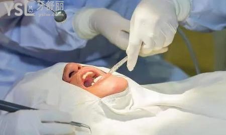 拔智齒后如何防止干槽癥？