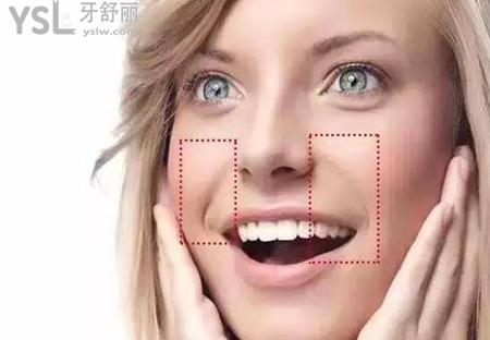 臉上法令紋怎么祛除？