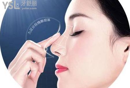 隆鼻期要多久？