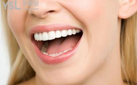 美容冠矯正牙齒多少錢？