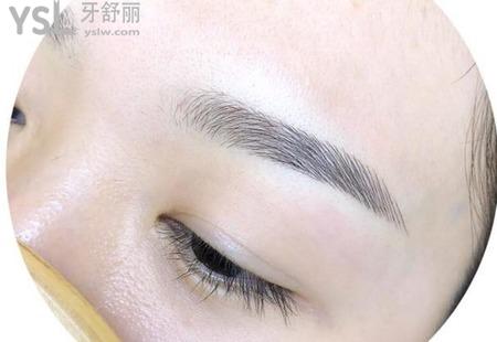 紋眉需要忌口幾天？