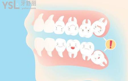 阻生智齒自己能長(zhǎng)正嗎？