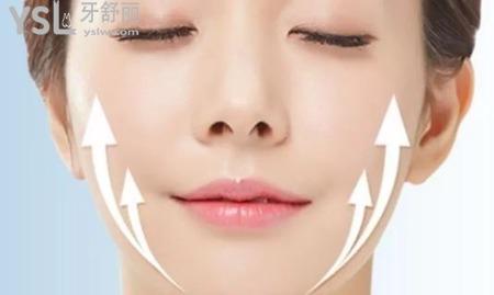 線雕期有多久,線雕后不戴頭套行嗎?