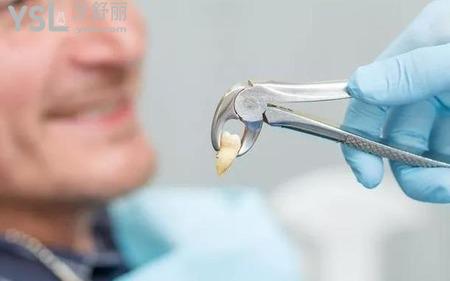 拔智齒后謹(jǐn)記注意事項(xiàng)和禁忌知多少?