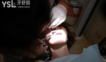 拔智齒花多少錢(qián)？到底幾天才好？