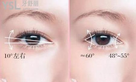全切雙眼皮術(shù)后的肉條一般多久消失？