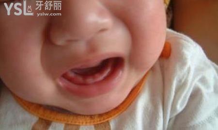 小孩九個月孩還沒有長牙,是什么原因?