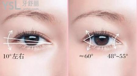 雙眼皮失敗癥狀以及如何修復(fù)?