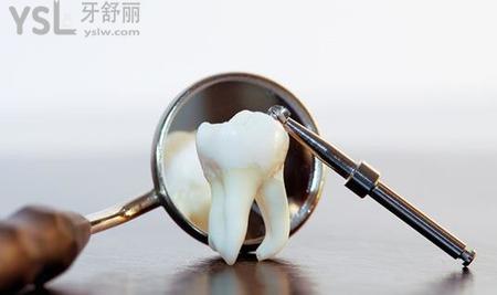  我最近有一顆牙經(jīng)常疼,是怎么回事？