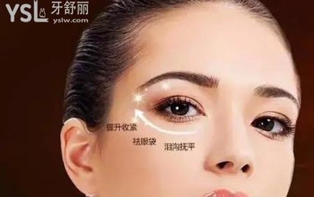 眼袋怎么消除呢?