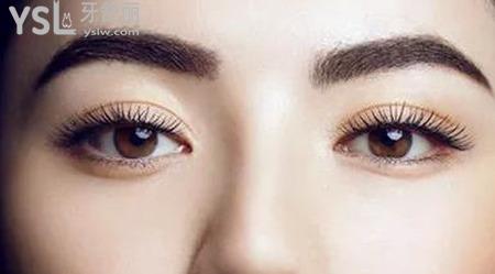 本身是雙眼皮還能割嗎？