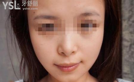臉一大一小是因為什么？