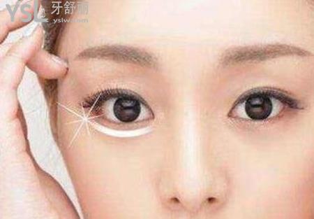 去除眼袋有幾種方法？