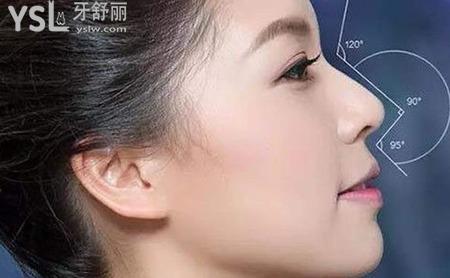 耳軟骨和肋軟骨成效一樣嗎？