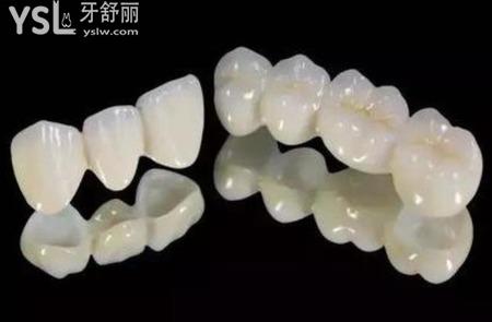 拔牙之后如果不補(bǔ)牙有什么影響？