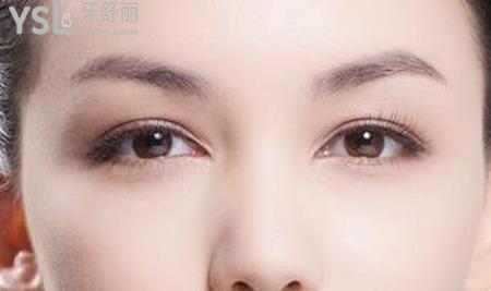 雙眼皮消腫化瘀有什么辦法？