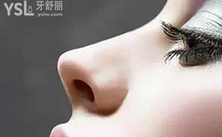 怎樣可以讓鼻子變成高挺鼻？