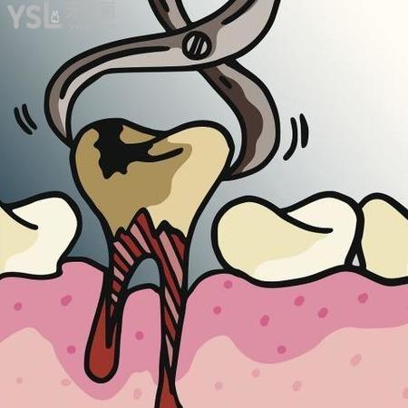 補(bǔ)完牙后牙疼怎么止痛？