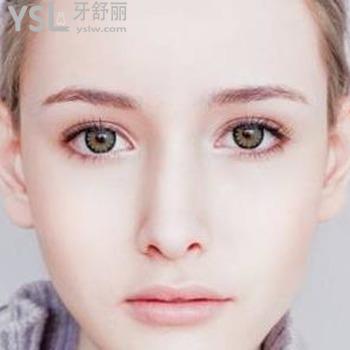 埋線雙眼皮拆線要多少錢？