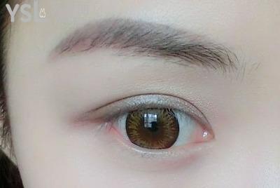 全切平行雙眼皮和歐式全切哪個的快？