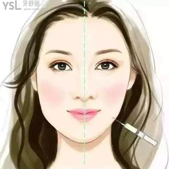 打完瘦臉針能化妝嗎？