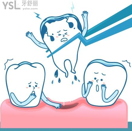 牙齒掉了，補(bǔ)牙報(bào)銷嗎？請問去西安市指定的醫(yī)保醫(yī)院去看口腔門診能報(bào)銷嗎?