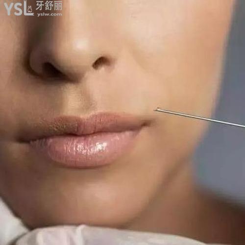 打瘦臉針有沒有副作用和后遺癥？