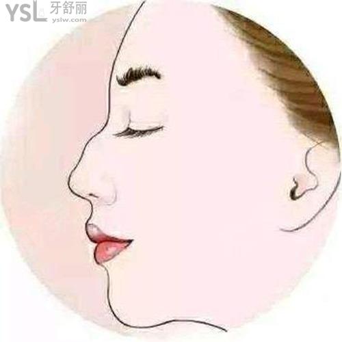 矯正駝峰鼻需要多少錢？