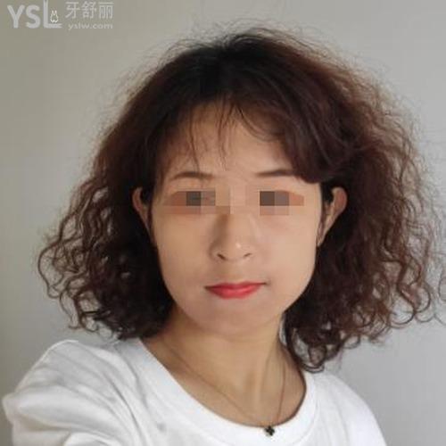 大小臉應(yīng)該睡哪邊糾正一下？