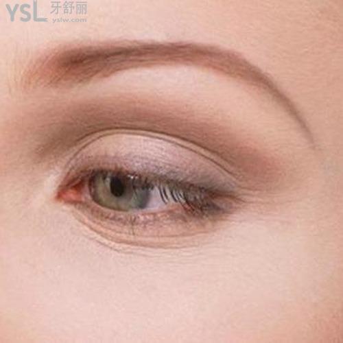去除眼角皺紋有什么辦法？