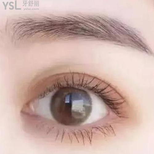 好的雙眼皮整形手術要怎么做？