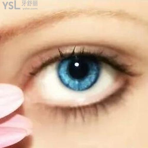 雙眼皮手術(shù)有哪些種類？