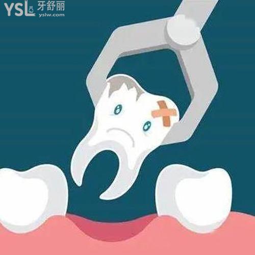 拔牙后需要注意什么事項(xiàng)？