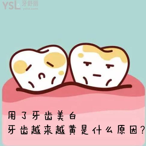 好苦惱！用了牙齒美白牙齒越來(lái)越黃是什么原因？