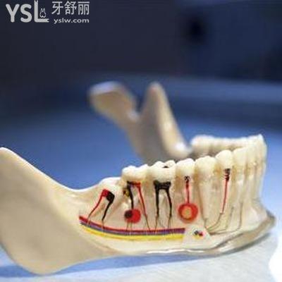 牙齒神經(jīng)痛會自動痊愈嗎？
