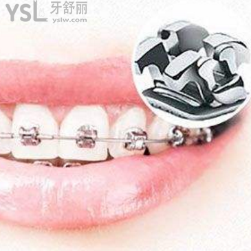 我想問下牙齒矯正醫(yī)保能報銷嗎？