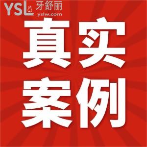 去無錫維樂口腔門診部看牙是怎樣的體驗(yàn)？真實(shí)評(píng)價(jià)在這里