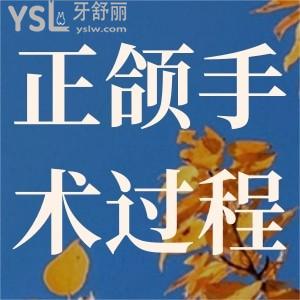 正頜手術(shù)過程是怎么樣的？