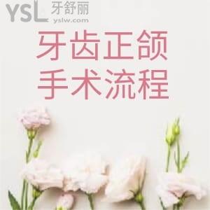 牙齒正頜手術(shù)流程是什么樣的?