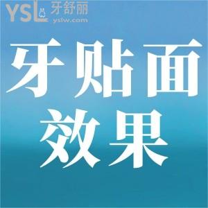 牙貼面成效如何？