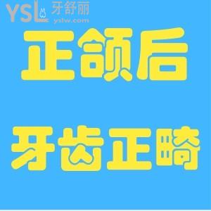 贛州章貢區(qū)能做正頜術(shù)后牙齒正畸的診所是哪里？哪位醫(yī)生能做？求推薦！