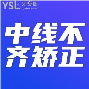 ?牙中線不齊需要矯正嗎？