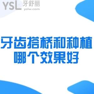 能不能說下牙齒搭橋和種植哪個(gè)成效好？費(fèi)用分別是多少？