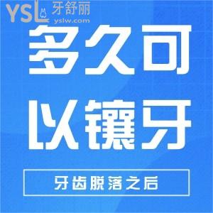 一般牙齒自然脫落后多長時間可以鑲牙種牙？