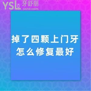 掉了四顆上門牙怎么修復(fù)較好,選擇種植牙不知價(jià)格貴不貴？