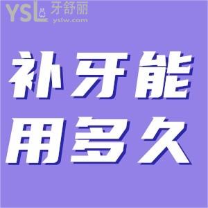 補(bǔ)一次牙能維持多久？
