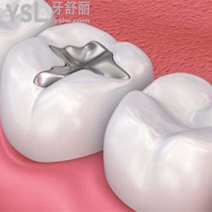補牙用什么材料較好最牢固？