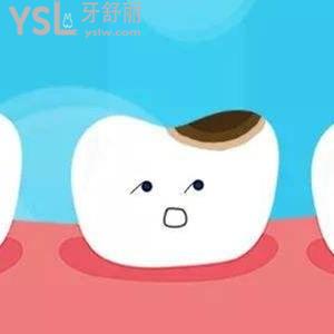 小孩補(bǔ)牙一般要用什么材料比較好？