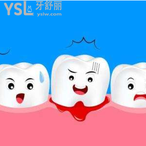 牙周炎和牙齦炎一樣嗎 怎么區(qū)別？