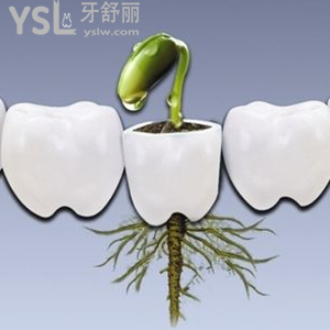 即拔即種種植牙好不好 有什么優(yōu)缺點？